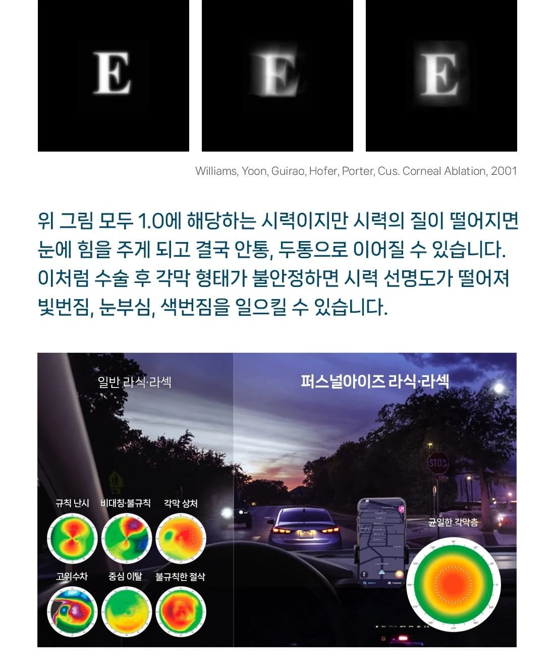 클리어서울안과 시력교정 이벤트 안내 이어짐 (14/24)