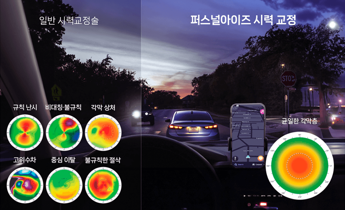 고위수차까지 조절하는 정밀 시력교정